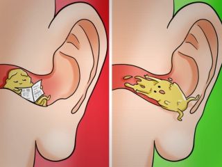 چند راهکار ساده و موثر برای حفظ تمیزی گوش ها