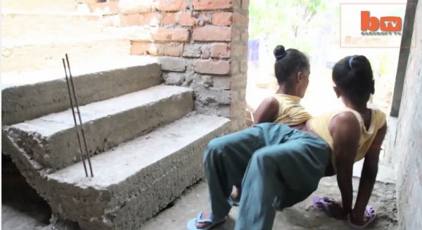 عشق یک مرد و دو خواهر دوقلوی به همچسبیده