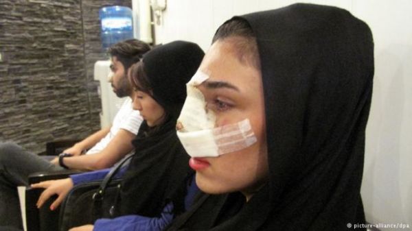 هزینه عمل بینی در شیراز