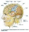 پیش‌ بینی ابتلا به شیزوفرنی با اسکن مغزی