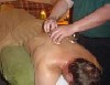 بادکش درمانى Cupping therapy