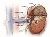 فیلیپین صادرکننده کلیه می شود 