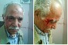 جراحت روی صورت حبیب الله پیمان بر اثر حمله لباس شخصی ها - عکس