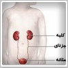 عفونت ادراری کودک چه علائمی دارد؟