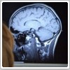 کشف «لکه سیاه» و لانه شیطان در مغز انسان 