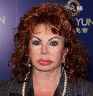 جراحی زیبایی و تزریق بوتاکس مادر سیلوستر استالونه در 90 سالگی جراحی زیبایی و تزریق بوتاکس مادر سیلوستر استالونه در 90 سالگی