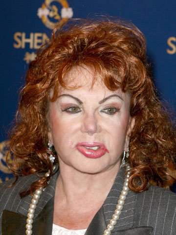 جراحی زیبایی و تزریق بوتاکس مادر سیلوستر استالونه در 90 سالگی جراحی زیبایی و تزریق بوتاکس مادر سیلوستر استالونه در 90 سالگی