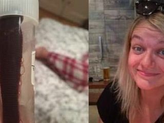 خارج کردن یک زالو از بینی خانم جوان