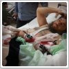 رهبر داعش در بیمارستان ترکیه