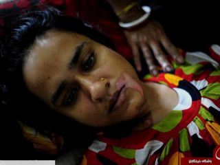 پدر شوهری که در دهان عروسش اسید ریخت