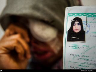 درگذشت سمیه مهری یکی از قربانیان اسیدپاشی بم