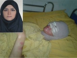 سزای پدری که به دخترش اسید پاشید
