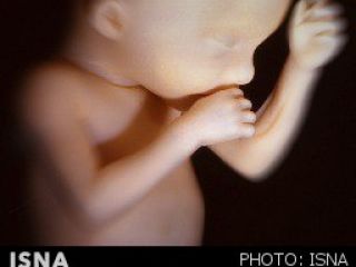 پرونده‌های عجیب پزشکی قانونی؛ ماجرای نوزادان ۲ سر