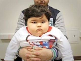 سفر تپل‌ترین کودک ایران از بجنورد تا تهران برای درمان