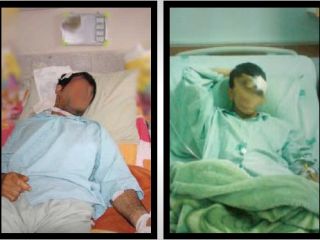 بدشانسی دزدان در خودروی آتشین