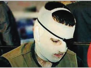 اجرای نخستین حکم قصاص چشم در ایران - یک چشم قصاص شد، ۲ چشم مهلت گرفت