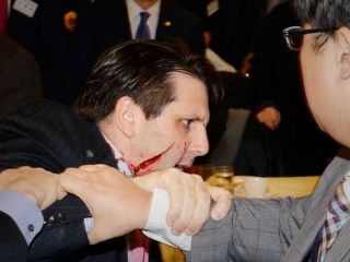 حمله به سفیر آمریکا با تیغ ریش تراشی