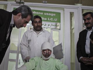 پای چپ محمدهادی، دانش آموز قربانی مین، از زانو قطع شد