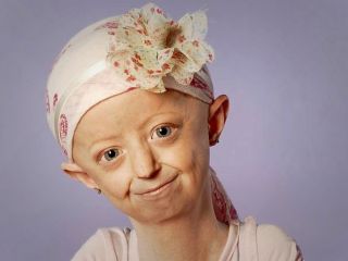 مرگ نوجوان ۱۰۰ ساله در سن ۱۷ سالگی