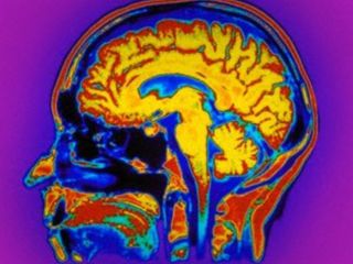 عمر مغز کمتر از تصورات پیشین است