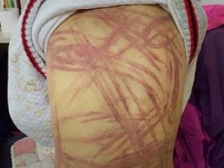 تنبیه وحشیانه پسر ۹ ساله با شلاق