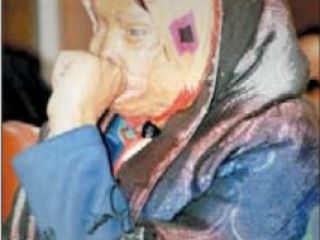 پدر قربانی اسیدپاشی :اسیدپاش را اعدام کنید