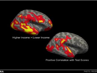 بخش مهمی از مغز کودکان فقیر رشد نمی‌کند