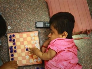 دختر ۱۹ ساله در بدن کودک دو ساله