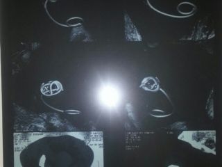 جاگذاشتن لوله ۲۰ سانتی در شکم بیمار