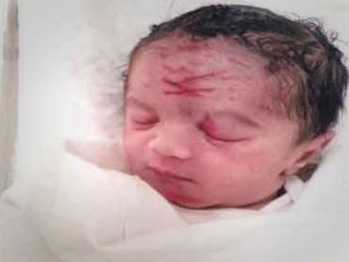 اشتباه وحشتناک پزشک هنگام سزارین