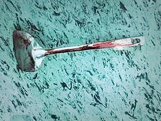 زنی برای خفه ‌نشدن کفگیر قورت داد