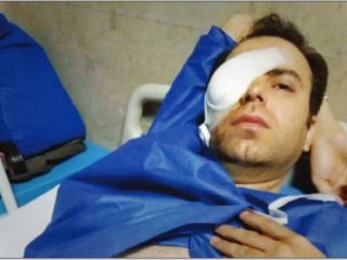 چشم قربانی خشم  / اختلاف بر سر جای پارک مقابل دانشکده سینما و تئاتر