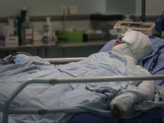 وقوع دو اسیدپاشی به روی زنان در کوهدشت و خوی در یک روز