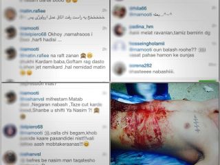 یک حادثه شرم آور در جامعه پزشکی؛ اینیسناگرام بازی با بدن بیمار!