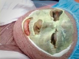 افشای انگیزه اسیدپاش آشنا به مادر و دختر