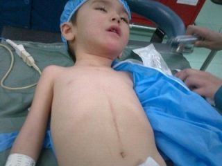 کودکان ایرانی قربانی رنگ شاد و طراحی زیبای لوله بازکن ها / یک کودک دیگر در کما