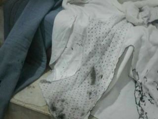 «دستگیری عامل اسیدپاشی» به سه زن در شهر بوکان