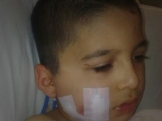 حمله خرس به کودک سرابی