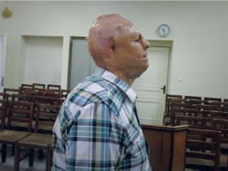 گره کور در حکم قصاص یک چشم