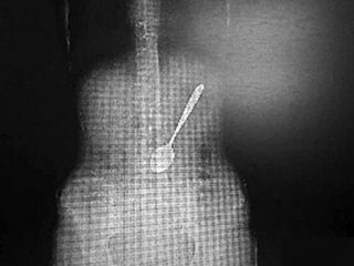 زنی که قاشق را بلعید!