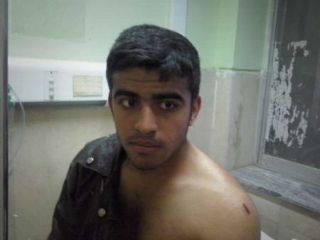 حمله شکارچیان با چاقو به محیط بان گلستانی