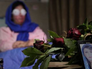 سهیلا جورکش اسید را شکست داد،نیروی انتظامی اسیدپاشان را نه