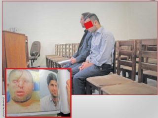 پایان پرونده اسیدپاشی به یک جوان با ۱۱ ماه زندان، پرداخت ۸۰ میلیون پول و یک آپارتمان