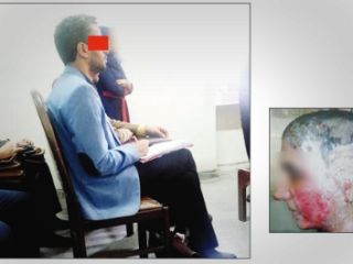 سناریوی عجیب مرد اسیدپاش در دادگاه