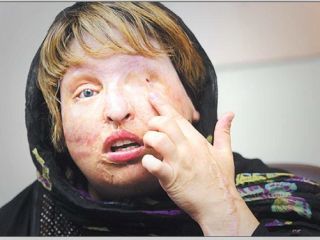 درخواست مجدد آمنه بهرامی از مسئولان :  کمک کنید راحت نفس بکشم