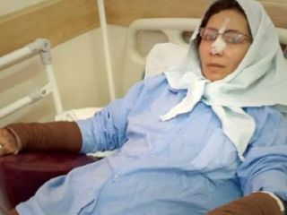 اسیدپاشی هولناک مادر روی دخترش در رفسنجان