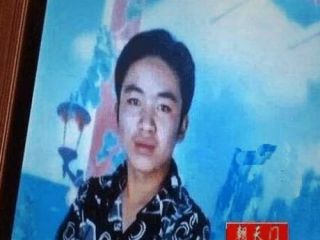 مرد ۳۰ ساله، ناگهان ۸۰ ساله شد!