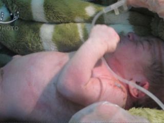 نوزاد سه روزه رهاشده در زباله‌های کنار جاده از مرگ نجات یافت