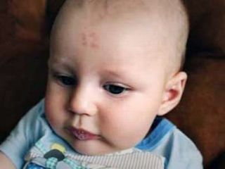 تولد نوزادی با عدد ۱۲ روی پیشانی