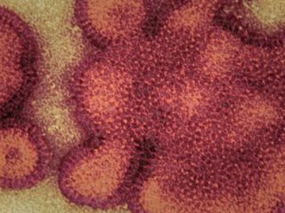 افزایش تلفات 'آنفلوانزی خوکی' در ایران، مدارس کرمان دو روز تعطیل شد